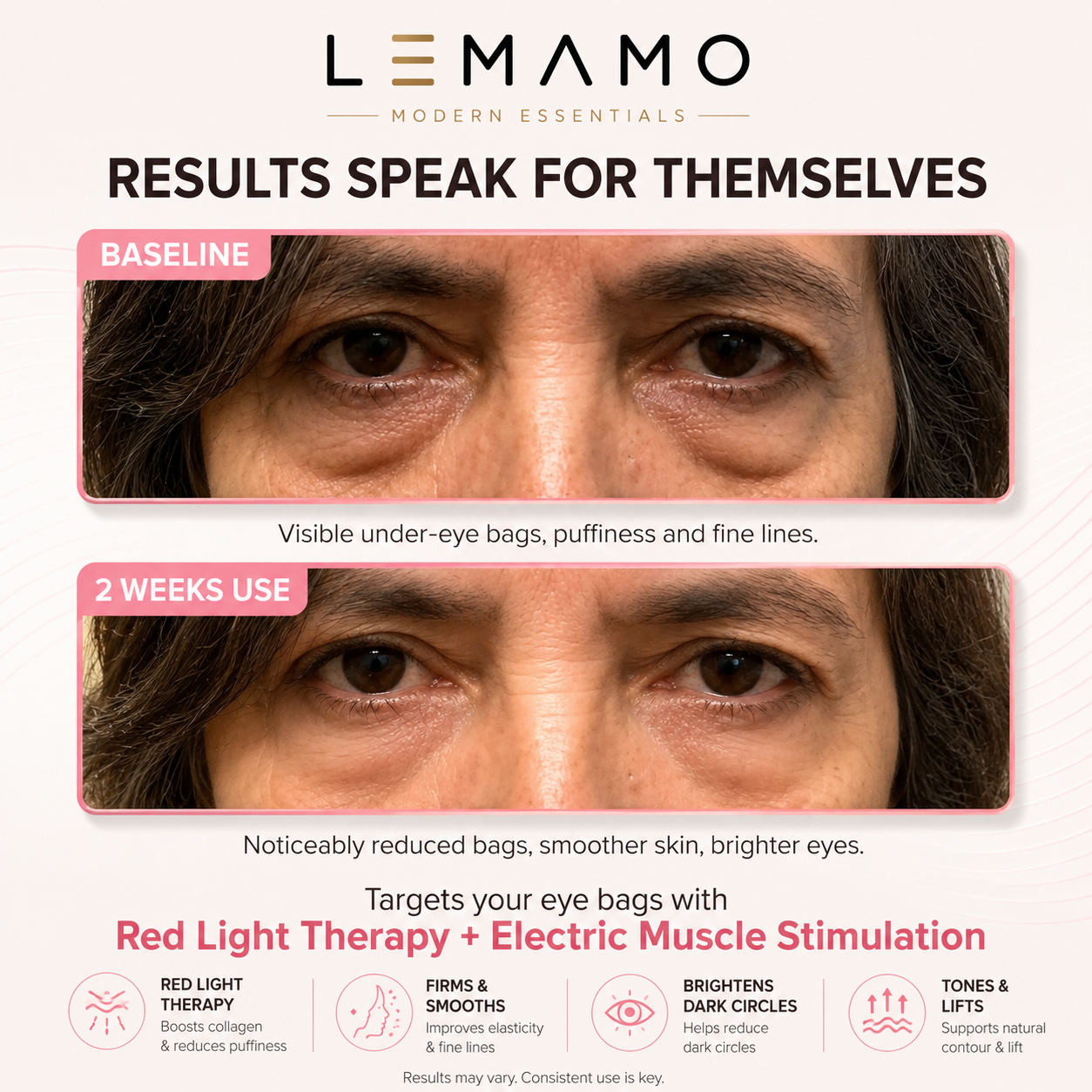 Lemamo Eye Massager